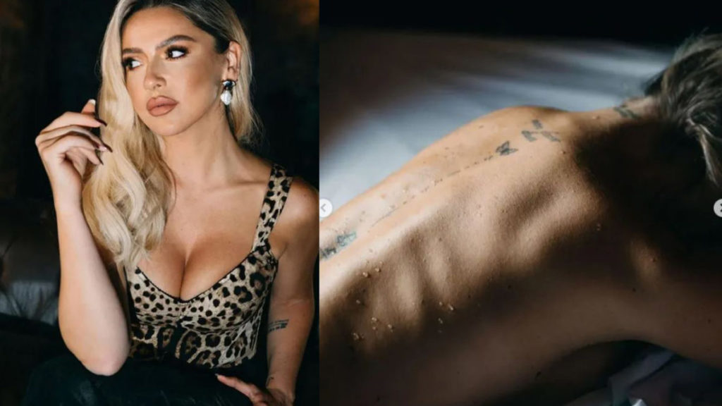 Hadise dolgun göğüs dekoltesi ve sırtındaki su kabarcıklarıyla nefisleri zorladı